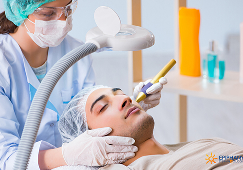 microneedling