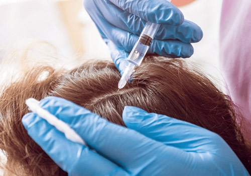PRP-for-Hairloss-Qatar-PRP-Treatment-Doha